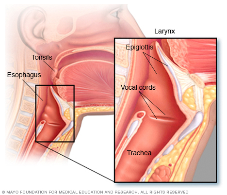 throat cancer